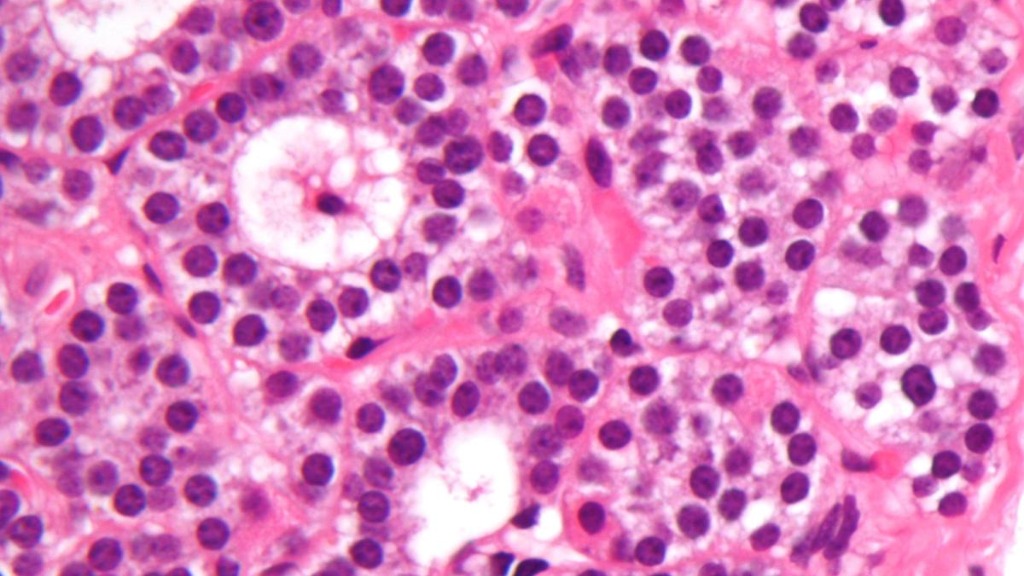 pack cover image